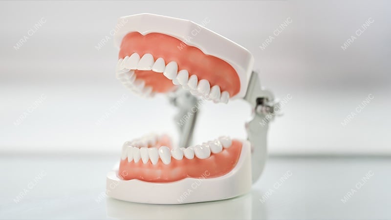 Loose dentures
